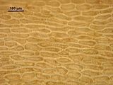 6 - Cellule corticali in visione superficiale